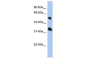 Tetraspanin 33 antibody used at 1 ug/ml to detect target protein. (TSPAN33 anticorps  (Middle Region))