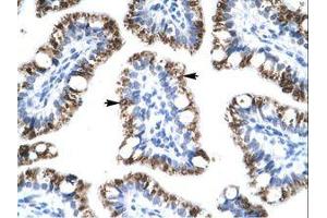 Image no. 3 for anti-Activating Transcription Factor 2 (ATF2) (AA 401-450) antibody (ABIN202679) (ATF2 anticorps  (AA 401-450))