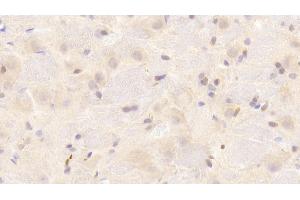 Detection of SNCa in Rat Cerebrum Tissue using Polyclonal Antibody to Synuclein Alpha (SNCa) (SNCA anticorps  (AA 23-140))