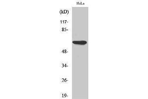 Western Blotting (WB) image for anti-Protein Kinase, AMP-Activated, alpha 1 Catalytic Subunit (PRKAA1) (Thr280) antibody (ABIN3179872) (PRKAA1 anticorps  (Thr280))