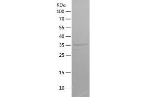 Western Blotting (WB) image for Chromosome X Open Reading Frame 61 (CXORF61) (AA 22-113) protein (His-IF2DI Tag) (ABIN7122396)
