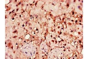 Immunohistochemistry of paraffin-embedded human placenta tissue using ABIN7155022 at dilution of 1:100