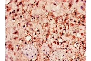 Immunohistochemistry of paraffin-embedded human placenta tissue using ABIN7155022 at dilution of 1:100 (HPSE anticorps  (AA 263-523))