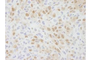 Immunohistochemistry (IHC) image for anti-Zinc Finger Protein 335 (ZNF335) (C-Term) antibody (ABIN7448692) (ZNF335 anticorps  (C-Term))