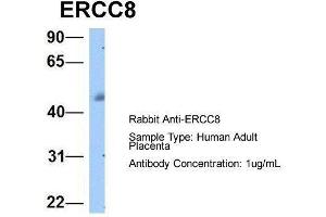 Host:  Rabbit  Target Name:  ERCC8  Sample Type:  Human Adult Placenta  Antibody Dilution:  1. (ERCC8 anticorps  (C-Term))
