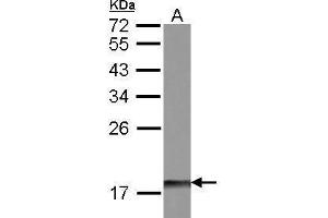 WB Image Sample (30 ug of whole cell lysate) A: IMR32 12% SDS PAGE antibody diluted at 1:500 (DUSP26 anticorps  (Center))