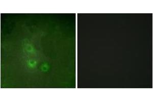 Immunofluorescence analysis of HuvEc cells, using FRK Antibody. (FRK anticorps  (AA 71-120))