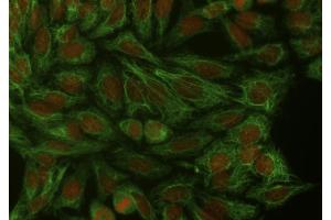 Immunocytochemistry staining of cytokeratin 18 in Hep-2 cells using mouse monoclonal antibody DA-7 ((ABIN94285), diluted 1:400), detected with GAM IgG-Alexa Fluor488 (diluted 1:200, green), cell nuclei stained with PI (1 μg/mL, orange). (Cytokeratin 18 anticorps)