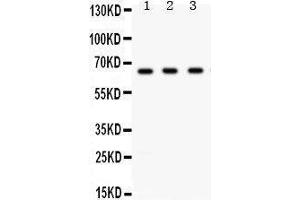 Western Blotting (WB) image for anti-Checkpoint Kinase 2 (CHEK2) (AA 465-498), (C-Term) antibody (ABIN3043811) (CHEK2 anticorps  (C-Term))