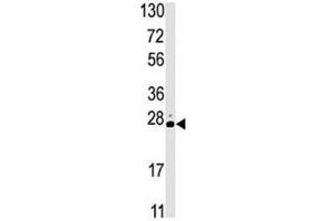 Western blot analysis of STK19 antibody and HL-60 lysate. (STK19 anticorps  (AA 278-308))