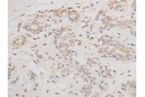 Immunohistochemistry (Paraffin-embedded Sections) (IHC (p)) image for anti-B-Cell CLL/lymphoma 2 (BCL2) antibody (ABIN1112797)