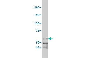 Western Blotting (WB) image for anti-P21-Activated Kinase 1 (PAK1) (AA 191-280) antibody (ABIN598852) (PAK1 anticorps  (AA 191-280))