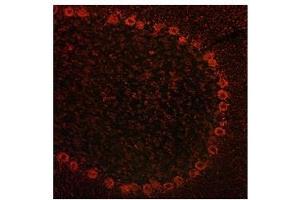 ADAM15 antibody used at a concentration of 10 ug/ml to detect cytoplasmin neurons in rodent brain (red). (ADAM15 anticorps  (Middle Region))