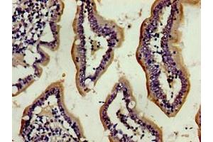 Immunohistochemistry of paraffin-embedded human small intestine tissue using ABIN7154035 at dilution of 1:100