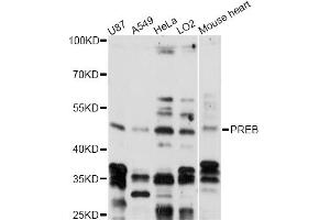 Western blot analysis of extracts of various cell lines, using PREB antibody (ABIN6291189) at 1:3000 dilution.