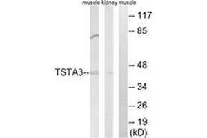 Western blot analysis of extracts from rat kidney/rat muscle cells, using TSTA3 Antibody. (TSTA3 anticorps  (AA 221-270))