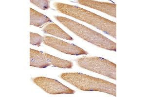 (ABIN6242694 and ABIN6578668) staining Vinculin in mouse skeletal muscle tissue sections by Immunohistochemistry (IHC-P - paraformaldehyde-fixed, paraffin-embedded sections).