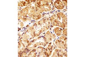 Immunohistochemical analysis of paraffin-embedded H. (POLDIP3 anticorps  (N-Term))
