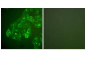 Immunofluorescence analysis of A549 cells, using Connexin 43 antibody. (Connexin 43/GJA1 anticorps  (C-Term))