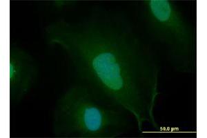 Immunofluorescence of monoclonal antibody to MYC on HeLa cell.