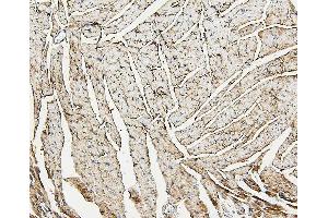 IHC analysis of ALDOA using anti-ALDOA antibody (ABIN7601907). (ALDOA anticorps  (AA 50-364))