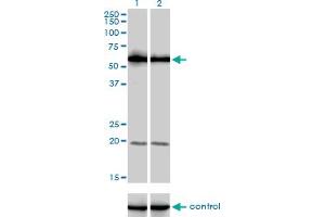 Western blot analysis of PIP5K3 over-expressed 293 cell line, cotransfected with PIP5K3 Validated Chimera RNAi (Lane 2) or non-transfected control (Lane 1).