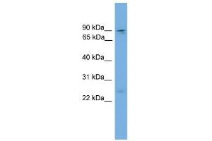 WB Suggested Anti-Zfy1 Antibody Titration: 0. (ZFY1 anticorps  (Middle Region))
