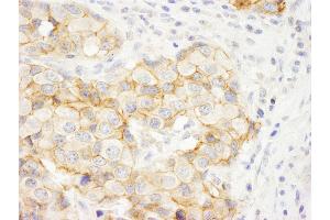anti-C2 Calcium Dependent Domain Containing 5 (C2CD5) (AA 375-425) antibody