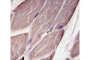 IHC analysis of FFPE human skeletal muscle tissue stained with PDK4