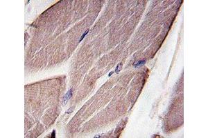 IHC analysis of FFPE human skeletal muscle tissue stained with PDK4 (PDK4 anticorps  (AA 250-277))