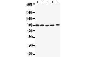 Western Blotting (WB) image for anti-Potassium Voltage-Gated Channel, Shaker-Related Subfamily, Member 4 (KCNA4) (AA 329-344), (Middle Region) antibody (ABIN3042541) (Kv1.4 anticorps  (Middle Region))