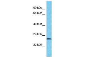 anti-Nuclear Pore Complex Interacting Protein-Like 2 (NPIPL2) (Middle Region) antibody
