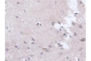 Detection of NAT1 in Mouse Cerebrum Tissue using Polyclonal Antibody to N-Acetyltransferase 1 (NAT1)