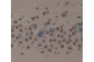 IHC-P analysis of Kidney tissue, with DAB staining. (LDOC1 anticorps  (AA 18-147))