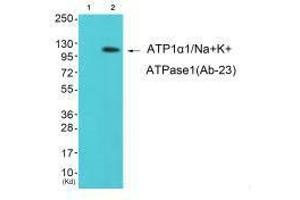 Western blot analysis of extracts from K562 cells (Lane 2), using ATP1α1/Na+K+ ATPase1 (Ab-23) antiobdy. (ATP1A1 anticorps  (Ser23))