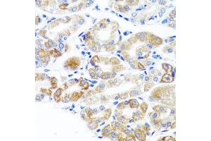 Immunohistochemistry of paraffin-embedded human stomach using DLG1 antibody at dilution of 1:100 (x40 lens). (DLG1 anticorps)