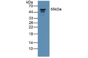 Western blot analysis of Human Jurkat Cells. (Coronin 1a anticorps  (AA 7-204))