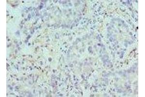 Immunohistochemistry (IHC) image for anti-Arginase, Type II (ARG2) (AA 1-354) antibody (ABIN6098038)