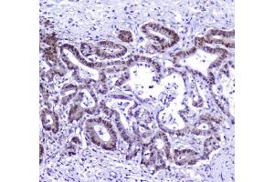IHC analysis of AHR using anti-AHR antibody (ABIN6719265).