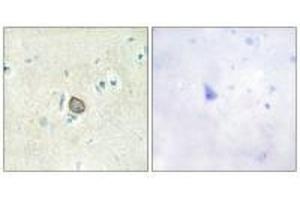 Immunohistochemistry analysis of paraffin-embedded human brain tissue using CELSR3 antibody. (CELSR3 anticorps)