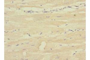 Immunohistochemistry of paraffin-embedded human heart tissue using ABIN7169499 at dilution of 1:100