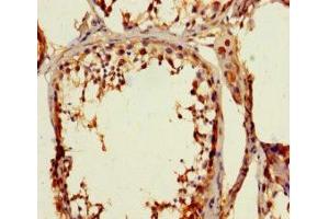 Immunohistochemistry of paraffin-embedded human testis tissue using ABIN7176521 at dilution of 1:100