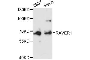 Western blot analysis of extracts of various cell lines, using RAVER1 antibody (ABIN6292264) at 1:3000 dilution.