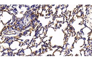 Detection of TM in Rat Lung Tissue using Polyclonal Antibody to Thrombomodulin (TM) (Thrombomodulin anticorps  (AA 31-167))