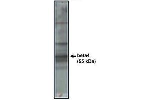 Image no. 1 for anti-Calcium Channel, Voltage-Dependent, beta 4 Subunit (CACNB4) antibody (ABIN265039) (CACNB4 anticorps)
