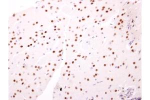 IHC-P Image NAB2 antibody detects NAB2 protein at nucleus on mouse fore brain by immunohistochemical analysis.