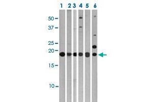 Western blot analysis of Lane 1: 293 cell lysates, Lane 2: Ramos cell lysates, Lane 3: HeLa cell lysates, Lane 4: HepG2 cell lysates, Lane 5: T47D cell lysates, Lane 6: Jurkat cell lysates with MAP1LC3C polyclonal antibody  at 1:1000 dilution. (LC3C anticorps  (AA 1-30))