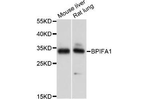 Western blot analysis of extracts of various cell lines, using BPIFA1 antibody. (BPIFA1 anticorps)