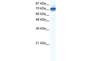 Western Blotting (WB) image for anti-Zinc Finger and SCAN Domain Containing 29 (ZSCAN29) antibody (ABIN2461307) (ZSCAN29 anticorps)