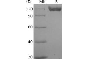 Western Blotting (WB) image for CD22 Molecule (CD22) (Active) protein (His tag,Biotin) (ABIN7319857) (CD22 Protein (His tag,Biotin))